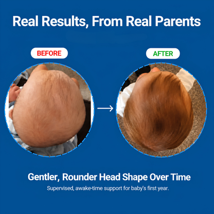 Mumera™ Adjustable Baby Head Shaping Pillow — Flat Head Protection for Newborns
